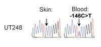 Somatic mutations in telomerase promoter counterbalance germline loss-of-function mutations
